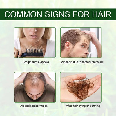 Illustration des causes de chute de cheveux traitées par l'huile capillaire : stress, alopécie, traitements chimiques et hormonaux.